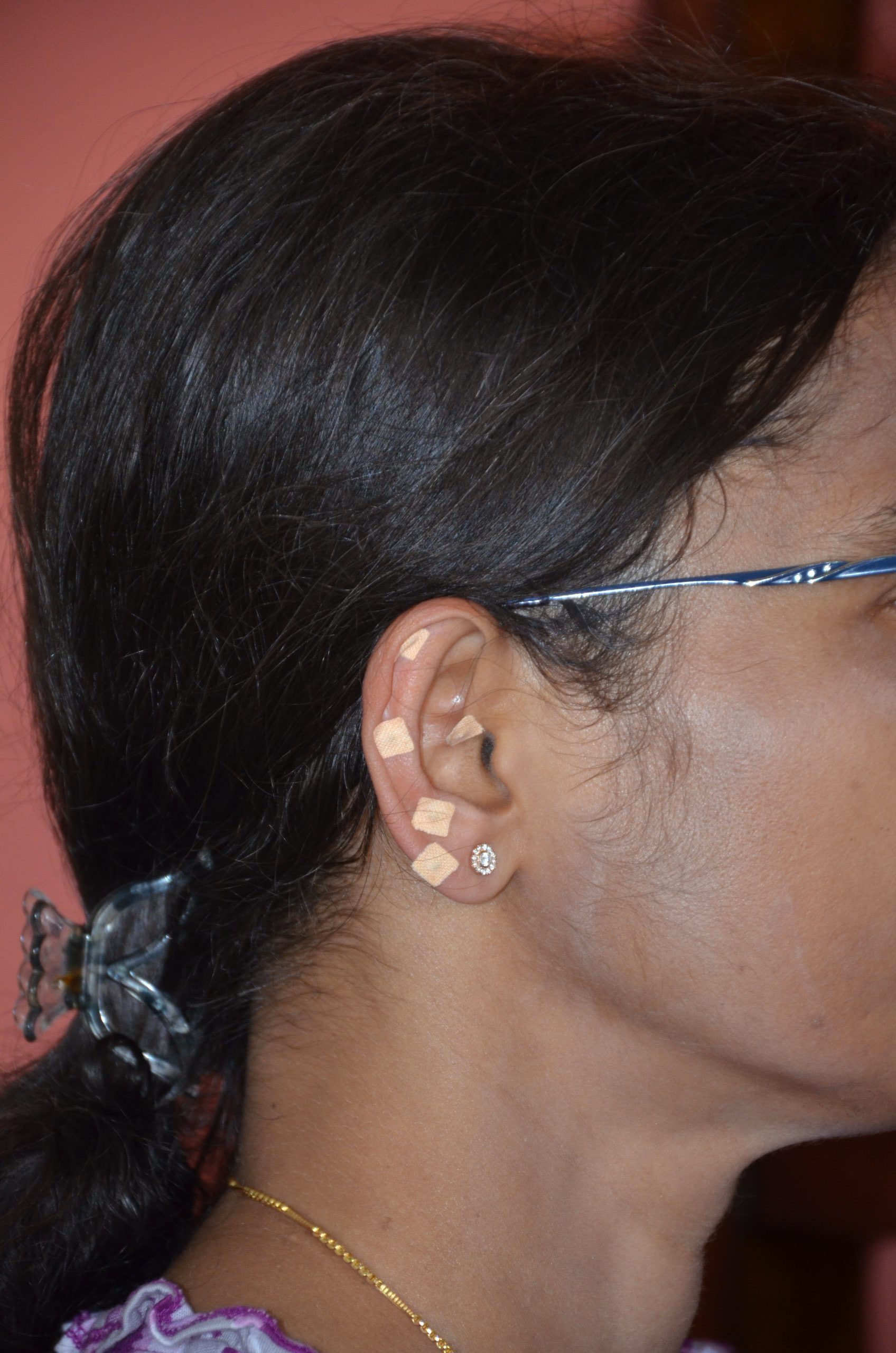 A woman with a band aid in her ear, embracing wellness and holistic self-care.